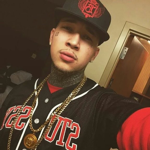 Anthony Baeza